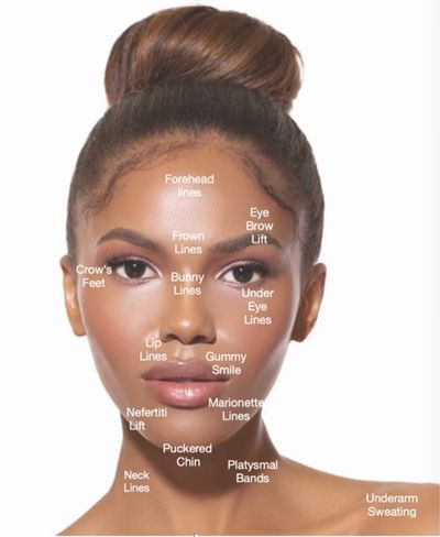 Botox and Daxxify